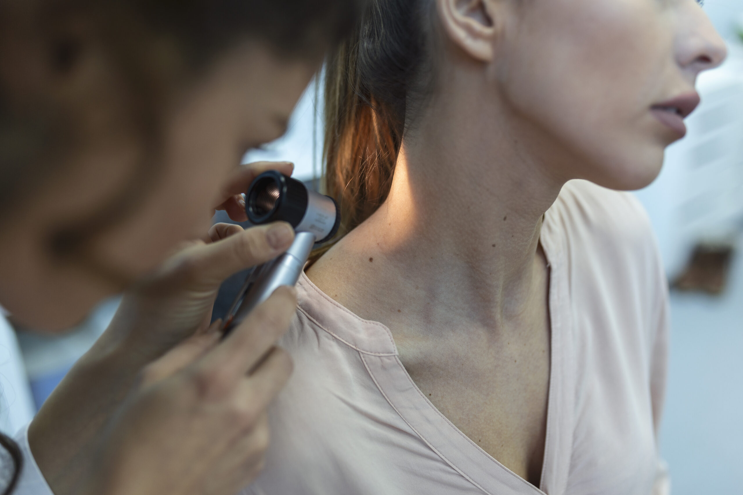 Can Radio Frequency Surgery Remove Skin Tags, Moles, Warts Permanently?