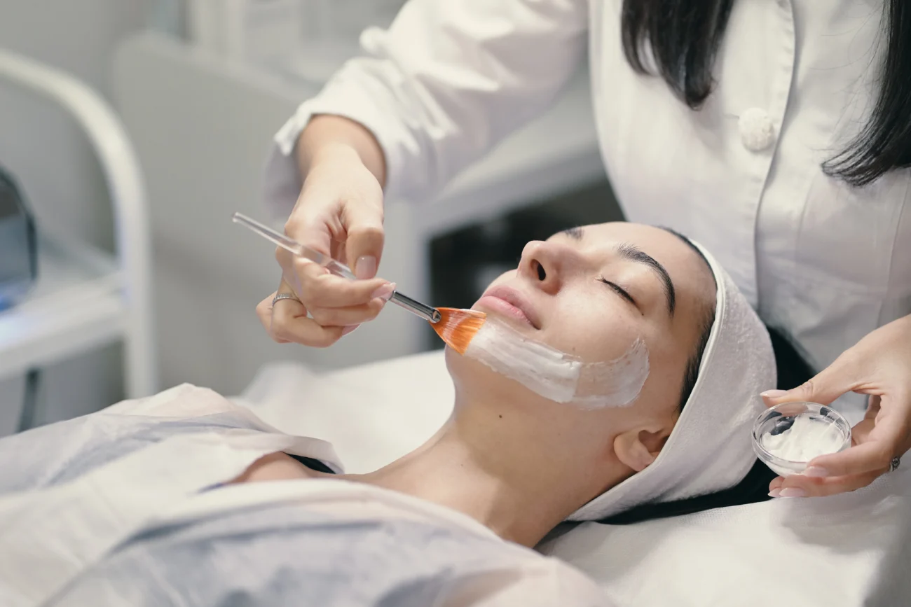 Chemical Peels