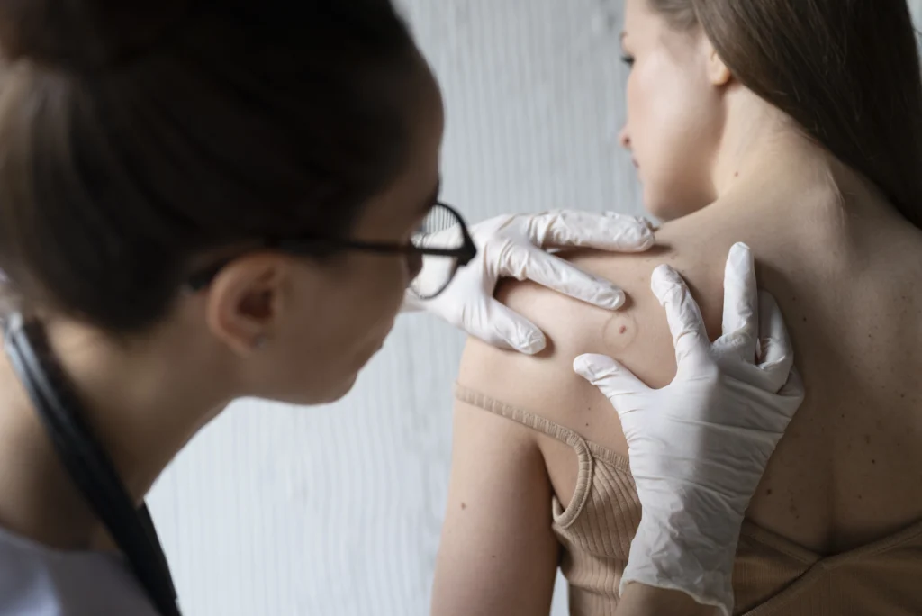 Acneiform Rash Back Back Acne 101: Causes, Triggers & Bacne Treatments